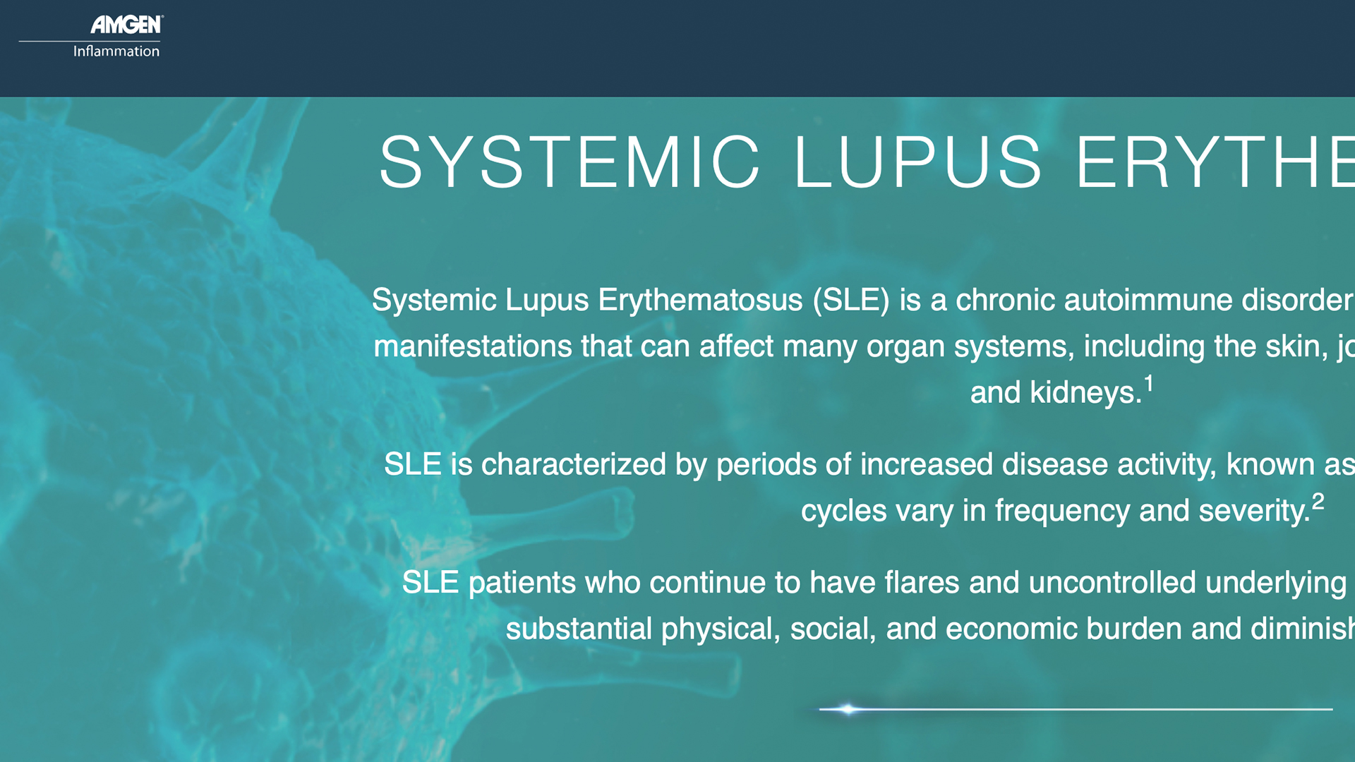 Inflammatory Pathways in Systemic Lupus Erythematosus