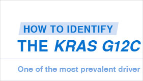 Identifying KRAS G12C in NSCLC Flashcard
